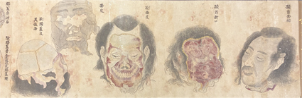 施薬院解男体臓図