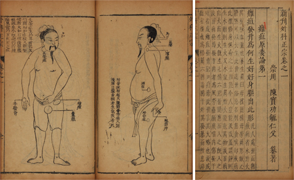 新刊外科正宗