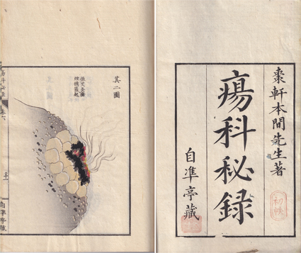 瘍科秘録　続瘍科秘録