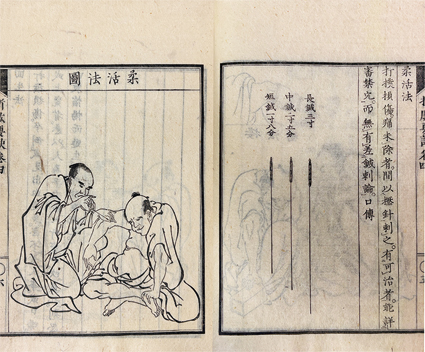 折肱要訣